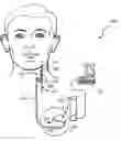 Fig. 01 - Method, apparatus and system for guiding a procedure relating to an implantable medical device