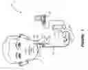 Fig. 02 - Method, apparatus and system for guiding a procedure relating to an implantable medical device