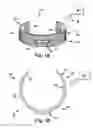 Fig. 02 - APPARATUS AND METHODS FOR TREATING PULMONARY CONDITIONS