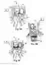 Fig. 06 - APPARATUS AND METHODS FOR TREATING PULMONARY CONDITIONS