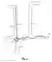 Fig. 05 - Spiral configurations for intravascular lead stability