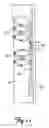 Fig. 12 - Spiral configurations for intravascular lead stability