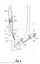 Fig. 07 - TRANSVASCULAR LEAD WITH PROXIMAL FORCE RELIEF