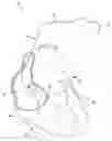 Fig. 01 - Expandable member for venous lead fixation