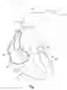 Fig. 02 - Expandable member for venous lead fixation