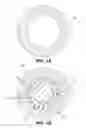 Fig. 02 - COMPLIANT CRIMPING SHEATH