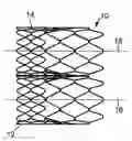 Fig. 01 - Stented heart valve devices and methods for atrioventricular valve replacement