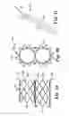Fig. 06 - Stented heart valve devices and methods for atrioventricular valve replacement