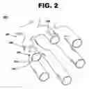 Fig. 03 - Implantable device with reservoirs for increased drug loading