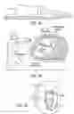 Fig. 04 - APPARATUSES AND METHODS FOR PERFORMING MINIMALLY INVASIVE DIAGNOSTIC AND SURGICAL PROCEDURES INSIDE OF A BEATING HEART