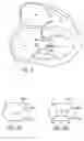 Fig. 06 - APPARATUSES AND METHODS FOR PERFORMING MINIMALLY INVASIVE DIAGNOSTIC AND SURGICAL PROCEDURES INSIDE OF A BEATING HEART