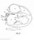 Fig. 07 - APPARATUSES AND METHODS FOR PERFORMING MINIMALLY INVASIVE DIAGNOSTIC AND SURGICAL PROCEDURES INSIDE OF A BEATING HEART