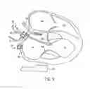 Fig. 09 - APPARATUSES AND METHODS FOR PERFORMING MINIMALLY INVASIVE DIAGNOSTIC AND SURGICAL PROCEDURES INSIDE OF A BEATING HEART