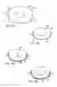 Fig. 20 - APPARATUSES AND METHODS FOR PERFORMING MINIMALLY INVASIVE DIAGNOSTIC AND SURGICAL PROCEDURES INSIDE OF A BEATING HEART