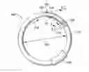 Fig. 01 - ADJUSTABLE CARDIAC VALVE IMPLANT WITH SELECTIVE DIMENSIONAL ADJUSTMENT