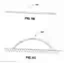 Fig. 08 - ADJUSTABLE CARDIAC VALVE IMPLANT WITH SELECTIVE DIMENSIONAL ADJUSTMENT