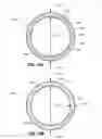Fig. 16 - ADJUSTABLE CARDIAC VALVE IMPLANT WITH SELECTIVE DIMENSIONAL ADJUSTMENT
