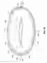 Fig. 20 - ADJUSTABLE CARDIAC VALVE IMPLANT WITH SELECTIVE DIMENSIONAL ADJUSTMENT