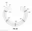 Fig. 30 - ADJUSTABLE CARDIAC VALVE IMPLANT WITH SELECTIVE DIMENSIONAL ADJUSTMENT
