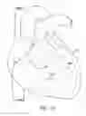 Fig. 12 - Devices and methods for absorbing, transferring and delivering heart energy
