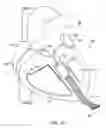 Fig. 13 - Devices and methods for absorbing, transferring and delivering heart energy