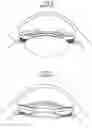 Fig. 07 - Intraocular lens system