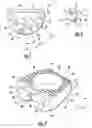 Fig. 02 - Orthopaedic implants and protheses