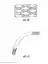Fig. 12 - URETERAL STENT WITH AXIAL AND RADIAL VARIABILITY