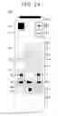 Fig. 14 - CONTENT REPRODUCTION APPARATUS, RECORDING MEDIUM, CONTENT REPRODUCTION METHOD AND CONTENT REPRODUCTION PROGRAM