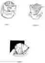 Fig. 02 - Infant head positioning device