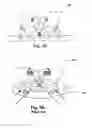Fig. 02 - Pressure relieving body support apparatus