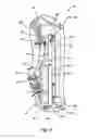Fig. 06 - Apparatus for tilting and securing a heat exchanger