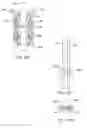 Fig. 94 - Wax barrier for use with in situ processes for treating formations