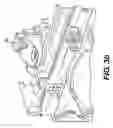 Fig. 07 - Adjustable mounting bracket and method for securing a part in place
