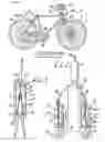 Fig. 02 - Dual bicycle braking system