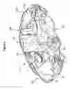 Fig. 03 - Disc brake caliper