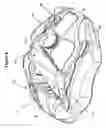 Fig. 07 - Disc brake caliper