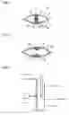 Fig. 05 - Fuel filter device