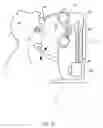 Fig. 02 - Orthovoltage radiotherapy