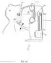 Fig. 02 - Orthovoltage radiotherapy