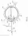 Fig. 04 - Orthovoltage radiotherapy