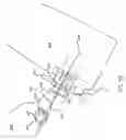 Fig. 34 - Orthovoltage radiotherapy