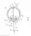 Fig. 04 - Orthovoltage radiotherapy