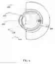 Fig. 22 - Orthovoltage radiotherapy
