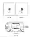 Fig. 28 - Orthovoltage radiotherapy