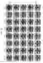 Fig. 09 - Image processing apparatus, image processing method and computer program