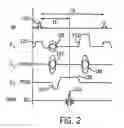Fig. 03 - MRI acquisition using 2D sense and partial fourier pace sampling
