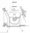 Fig. 07 - Cleaning device for image forming apparatus