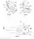 Fig. 06 - Hole saw with depth stop