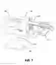 Fig. 08 - Microscope Slide Load/Unload Mechanism